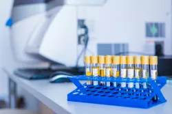 Лабораторные диагностические исследования Лабораторные диагностические исследования