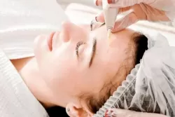 Карбокситерапия