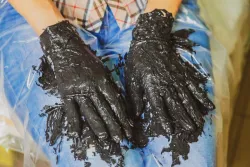 Грязелечение